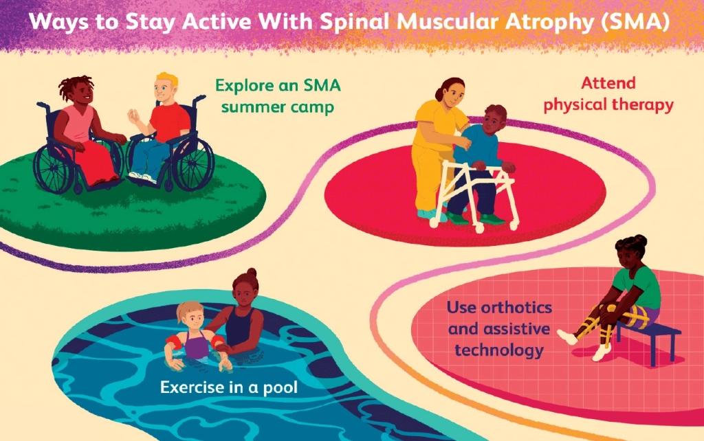 live with spinal muscular atrophy